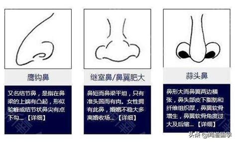 面像 鼻子|鼻相分析10款｜鼻樑有節及橫紋、豬膽鼻、鼻頭下垂代表甚麼？姻 